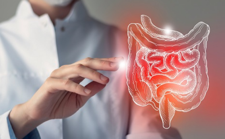 Viêm đại tràng: Nguyên nhân, triệu chứng, chẩn đoán và các phương pháp điều trị, phòng ngừa